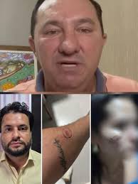 Secretário é preso de novo e deputado exige exoneração imediata