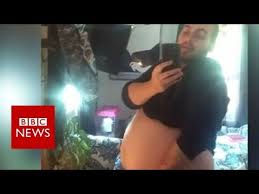 I'm a hermaphroditic intersex person (medical term is 'true hermaphrodite'), and i have both male and female reproductive organs in the usual places. I Gave Birth As Both Genders Bbc News Youtube