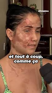Sous un élan de colère, elle a défiguré le visage de sa fille pour toujours  ...