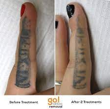 This Inner Finger Tattoo Had Been Touched Up Twice Before And Then Covered With A Bullet Which Never He Finger Tattoo For Women Tattoo Touch Up Finger Tattoos
