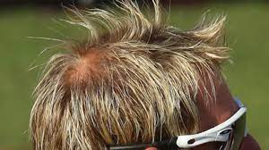 Shane warne has been undergoing hair loss treatment with advanced hair … shane warne's hair regrowth journey. Shane Warne Advanced Hair Studio Ad Cut