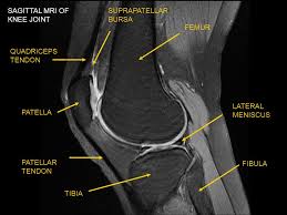 These are essential structures to evaluate in routine assessment of the knee on mri. Lower Extremity X Rays Mris And Angiograms Ppt Video Online Download