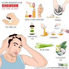 7 Home Remedies To Fight Ringworm Of The Scalp Top 10 Home Remedies Home Remedies For Ringworm Ringworm Remedies Get Rid Of Ringworm