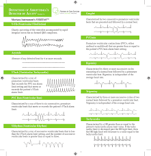 definitions of arrhythmias detected by acuity version 7 x a