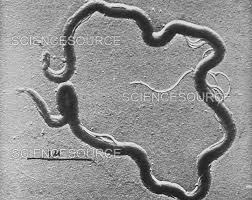 Image result for Treponema