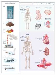 Image result for Lead Poisoning