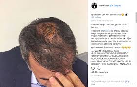 Olaylı derbide kafası yarılan beşiktaş teknik direktörü şenol güneş'in kafasındaki dikişlerin sahte olduğu yönünde iddialar ortaya atılmıştı.güneş'in yakından çekilmiş bu fotoğrafı klavye. Ryan Babel Ve Tosic Ten Senol Gunes Tepkisi Son Dakika Besiktas Haberleri Transfer Puan Durumu Ve Fikstur Siyahlabeyaz Net