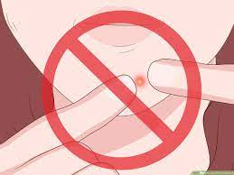 How to get rid of keloid scars. 3 Ways To Get Rid Of Keloids Wikihow