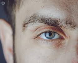 Eye floaters can happen to anyone as they age. How To Resolve Eye Floaters Top Doctors