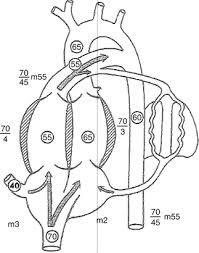 Image result for Delayed Transition from Fetal Circulation