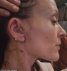 Fearne Cotton shares health update after undergoing surgery to remove two  tumours