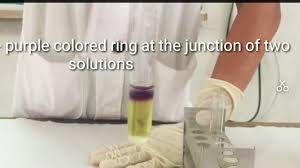 Prophylactic alkalization of the urine during cytostatic tumor treatment. Rothera S Test For Detection Of Ketone Bodies In Urine Youtube
