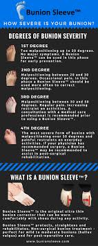 Bunion Sleeve The Original Ultra Thin Bunion Corrector Bunion Remedies Bunion Bunion Treatment