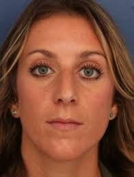 Gallery Cases Archive