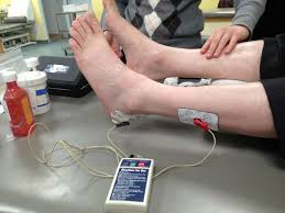 As of now i am icing and massaging, have pretty much stopped running and am resting. Acetic Acid Iontophoresis For The Treatment Of Insertional Achilles Tendonitis Bmj Case Reports