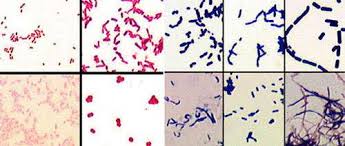 Les bactéries sont de minuscules êtres vivants microscopiques, unicellulaire et procaryote, présents dans tous les milieux.malgré leur petitesse, on peut. Les Differentes Bacteries Gram Et Sa Coloration Dossier