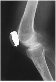 Find out all of the player trades, signings and free agency information at fox sports. Radiographic Artifacts Radiology Key