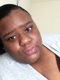 Introduction after gastric sleeve surgery