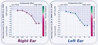 Pin On Hearing General