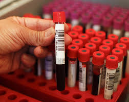 First 'Blood Test for Depression' Holds ...