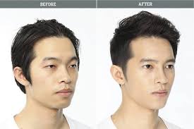 Her after photos reveal a much more alert, feminine appearance to the eyes. Pin On China Fesitvals