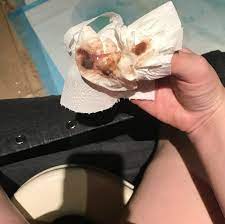 Mucus Plug 101 Who What Where When Why With Photos