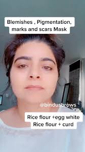 Natural Home Remedies for Pigmentation and Scars