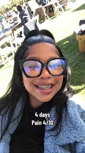 Rating the pain level, but my overall experience was not horrible but also  not fun. Day 3 was hell #fypシ #braces #whoisthuli #bracesjourney  #bracesinstallation