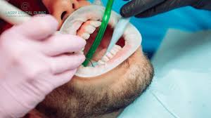 How much does deep teeth cleaning cost? How Much Does A Teeth Cleaning Cost Lasry Dental Clinic