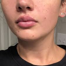 TOP 10 BEST Dysport in DeLand, FL