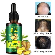 Related reviews you might like. 30ml Hair Growth Serum Essence For Women And Men Anti Preventing Hair Loss Alopecia Liquid Damaged Hair Repair Growing Faster Hair Loss Products Aliexpress