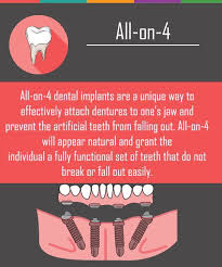 Apr 12, 2021 · government grants for dental implants will prove very hard to find. We Are Sensitive To The Hardships A Missing Tooth Can Create And Can Provide Dental Implants So That Our Patients Can Regai Emergency Dentist Dental Dental Fun
