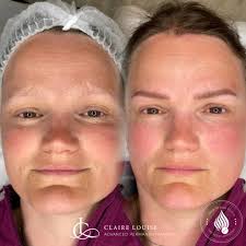 Do tattooed eyebrows look unnatural? Not if they're created by the right  person, using the right technique, latest technology and best quality  pigments. 👌 I absolutely love these. Natural fluffy looking textured