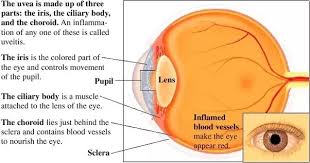 Uveas), also called the uveal layer or vascular tunic is the middle of the three layers that make up the eye. What Is Uvea Quora