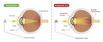 How to test for astigmatism. Sorry But These Viral Images Can T Actually Diagnose Astigmatism