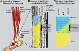The achilles tendon or heel cord, also known as the calcaneal tendon, is a tendon at the back of the lower leg, and is the thickest in the human body. A 3d Model Of The Achilles Tendon To Determine The Mechanisms Underlying Nonuniform Tendon Displacements Sciencedirect