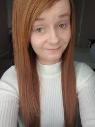 Emily's candle warning after sustaining significant burns