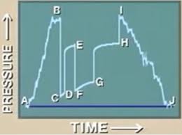 Dst Pressure Chart The Initial Phase Of The Test Is