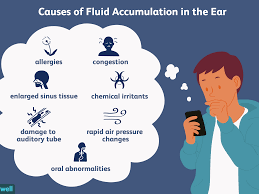 Maybe you would like to learn more about one of these? Otitis Media With Effusion Treating Fluid In The Ear