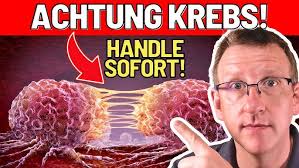 Diagnose Darmkrebs. Was passiert nun? Tim Wessels