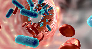 People in an intensive care unit are more likely to develop infections that can then lead to sepsis. Forscher Untersuchen Zusammenbruch Des Immunsystems Bei Sepsis