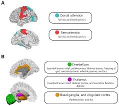 Image result for Neurologic Lesion Localization