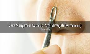 Buang air kecil melebihi batas normal untuk waktu yang lama bisa menjadi gejala dari kondisi medis tertentu. Cara Mengatasi Komedo Putih Di Wajah Whitehead Eva Mulia Clinic