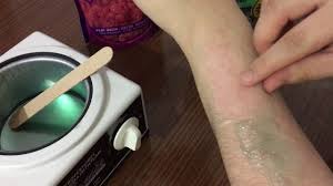 Acisiz Agda Olur Mu Cevabi Bu Videoda Inci Agda Youtube