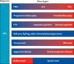 Image result for Progressive Bulbar Paralysis