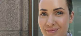 Sandra tok fillers i leppene