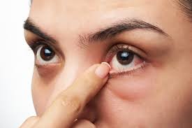 We did not find results for: This Is Why Your Eye Won T Stop Twitching The Washington Post