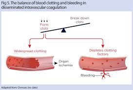 Image result for Coagulation Bleeding Disorder