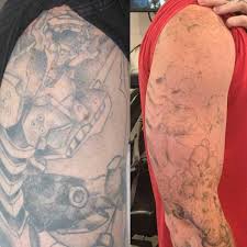 Future tattoos new tattoos body art tattoos tattoos for guys sleeve tattoos cool tattoos tatoos buddha tattoos computer tattoo. Full And Half Sleeve Tattoo Removal Removery