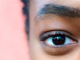 3 ﻿ patients may wake up to find one or both eyes stuck together with mucus when they wake up in the morning. Dry Eyelids Here S Exactly How To Treat Them According To Dermatologists Self